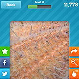  Sea Urchin 
