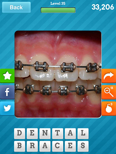  Dental Braces 