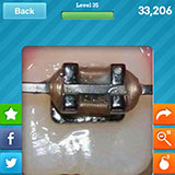  Dental Braces 