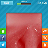 Tonsils 