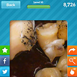  Whelks 